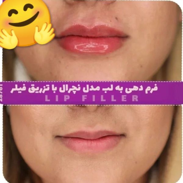 پیرسینگ گوش،ناف،بینی و .... در تهرانسر